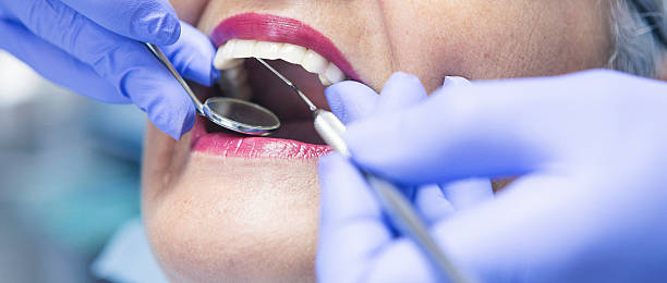 Best Emergency Dentist for Lost Fillings or Crowns in Dexter, OR